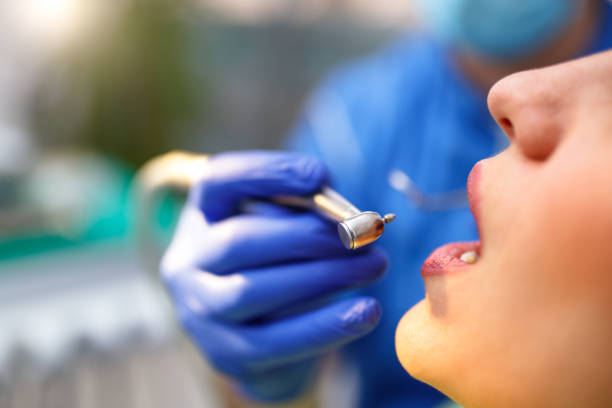 Dental Inlays and Onlays in Corte Madera, CA